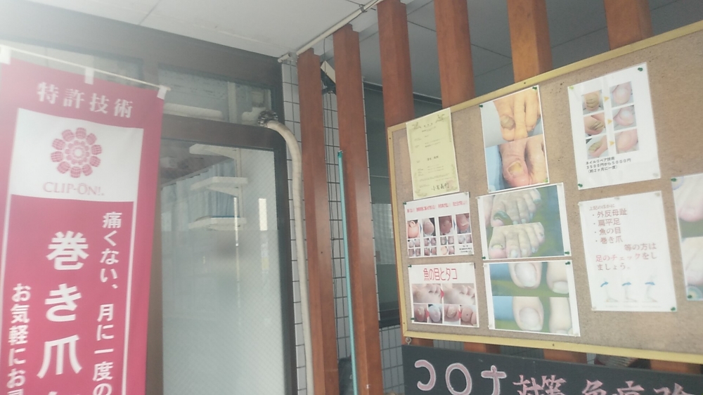 巻き爪補正スクールクリップオン